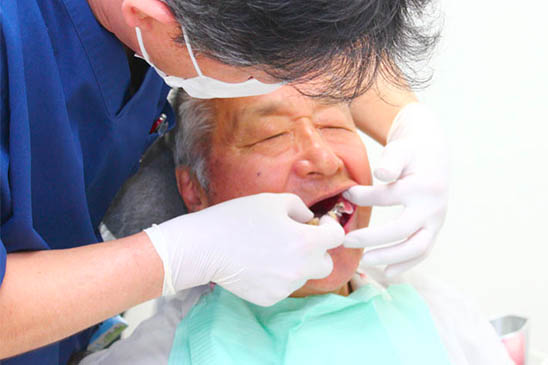 入れ歯専門の歯科医師が治療