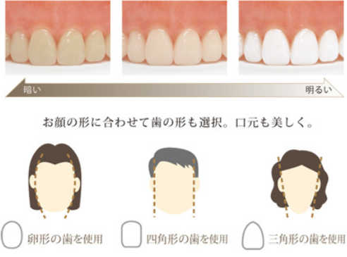 歯・歯茎の色を選べる