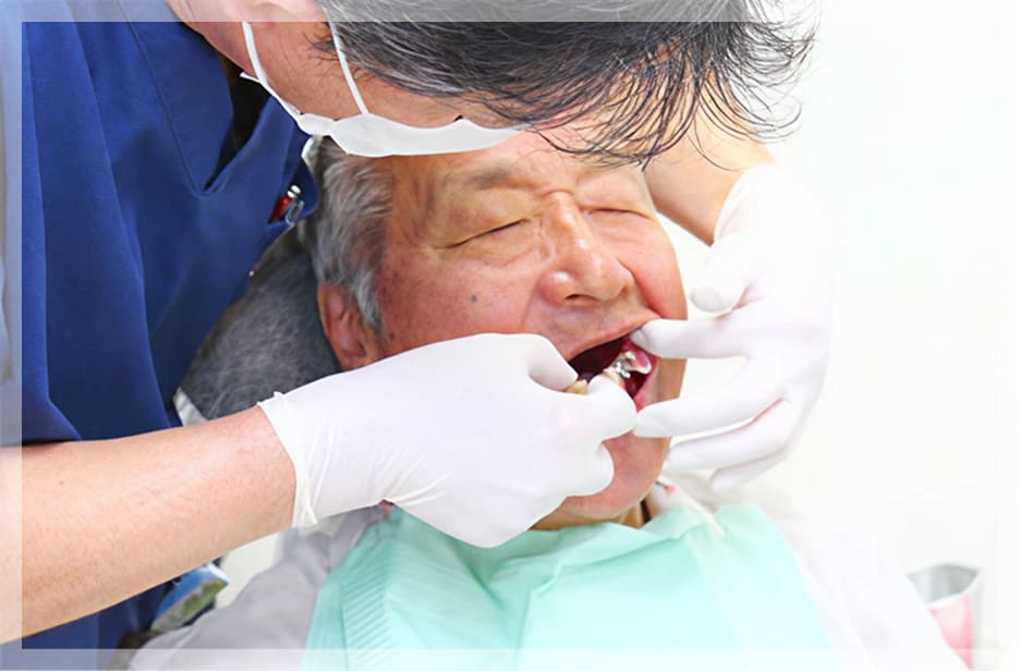 入れ歯専門チーム